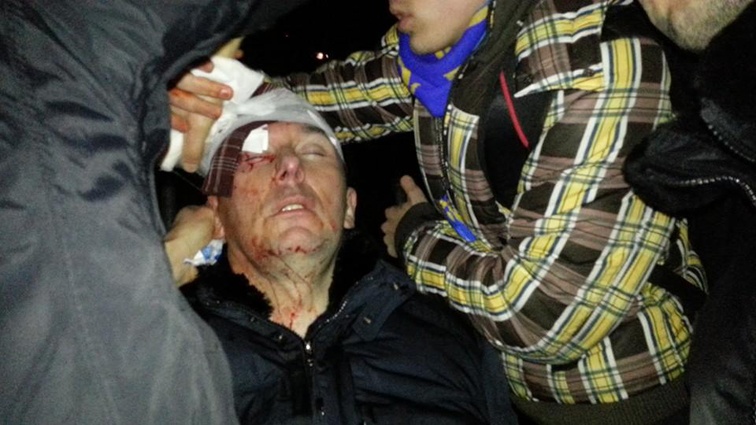 В ночь на 11 января 2014-го Юрий Луценко пострадал в ходе столкновений на Майдане с бойцами «Беркута». «Я в первой волне был, с меня «космонавты» очки сбили, и только из-за этого среди основных пострадавших я не был»